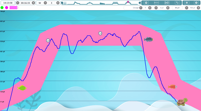 image biofeedback 8